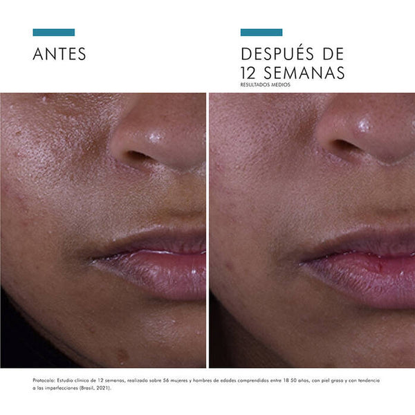 SkinCeuticals SILYMARIN CF Sérum de Vitamina C: Acné y Piel Grasa 30ML
