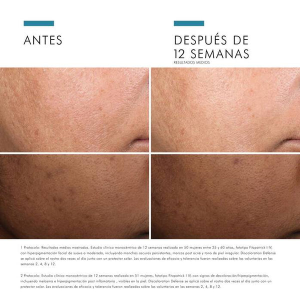 SkinCeuticals DISCOLORATION DEFENSE Sérum Despigmentante 30 ML