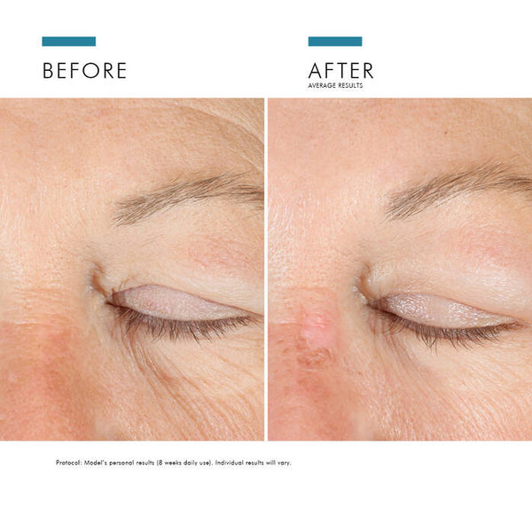 SkinCeuticals AGE ADVANCED EYE Crema Antiojeras y Arrugas 15 ML