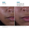 SkinCeuticals SILYMARIN CF Sérum de Vitamina C: Acné y Piel Grasa 30ML