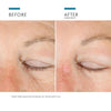 SkinCeuticals AGE ADVANCED EYE Crema Antiojeras y Arrugas 15 ML